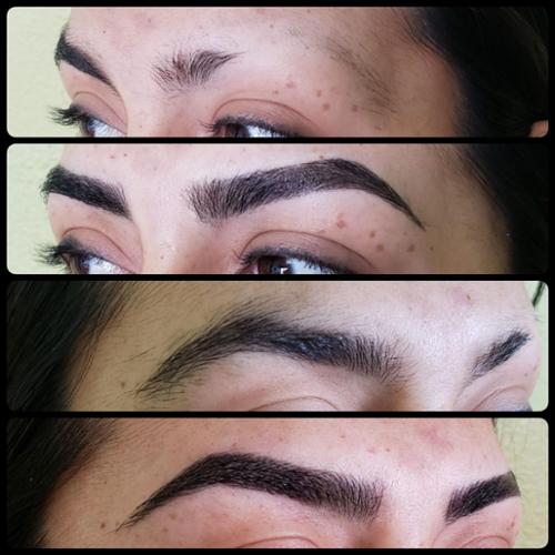 Alopecia fill in and shaping.